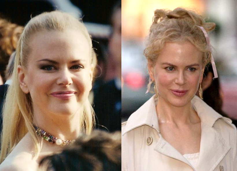 Did Nicole Kidman Have Plastic Surgery? Investigating The Evidence